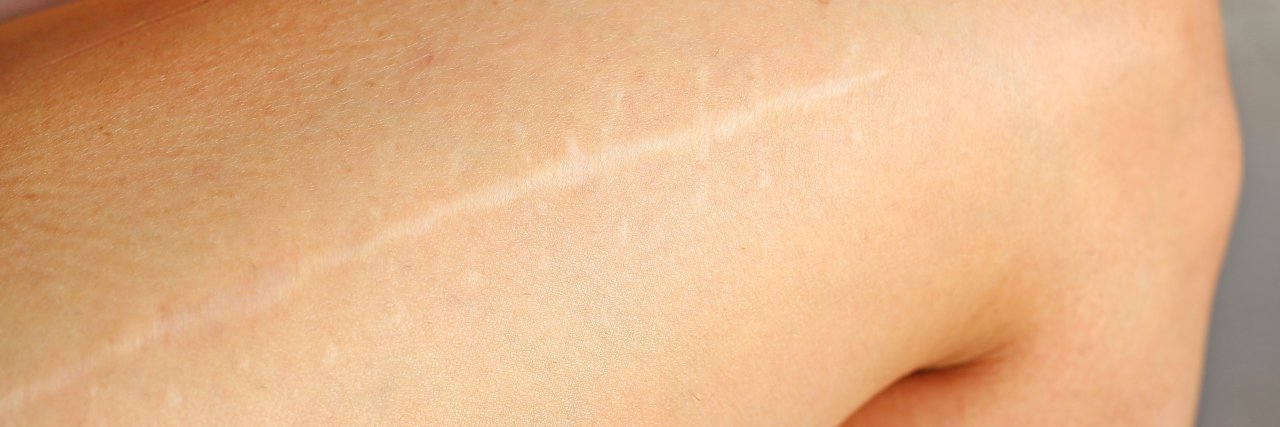 GettyImages-663261818-1280x427